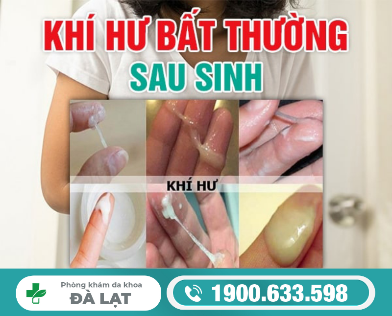 Hình ảnh minh họa